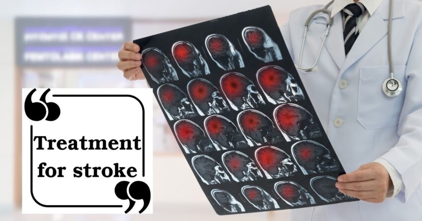 treatment for stroke - healthwishing